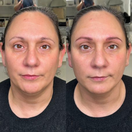 Antes y después micropigmentación cejas Noblesse Beauty Mallorca
