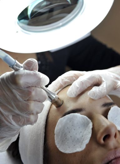 Microdermoabrasión Higiene facial
