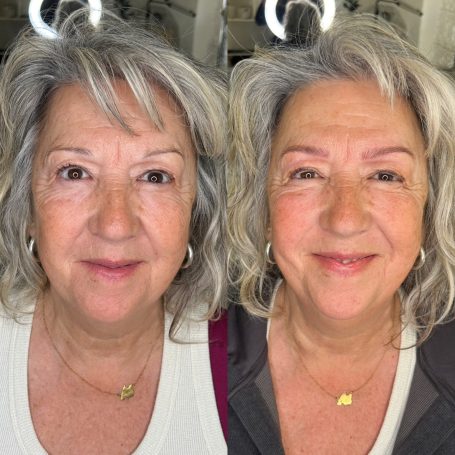 Antes y después hairstrokes cejas micropigmentación Menorca Mallorca

