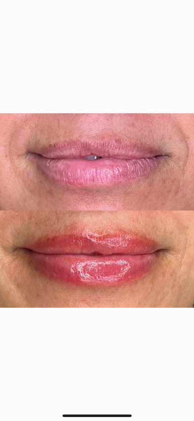 Antes y después Resultado final de micropigmentación de labios natural