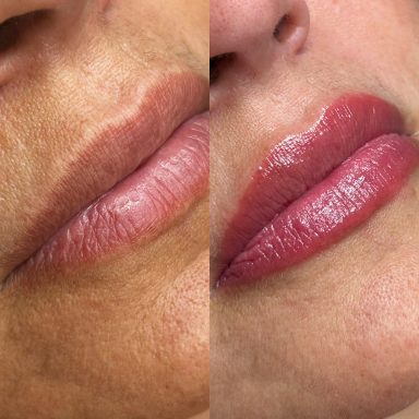 Antes y después Resultado final de micropigmentación de labios natural