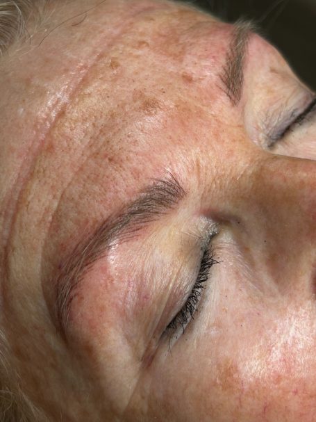 Corrección cejas realista Mallorca Corrección de cejas asimétricas con micropigmentación pelo a pelo